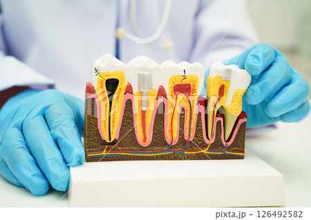 Dentist holding dental implant, artificial tooth roots into jaw, root canal of dental treatment, gum disease, teeth model for dentist. Dentist holding dental implant, artificial tooth roots into jaw, root canal of dental treatment, gum disease, teeth model for dentist. 126492582