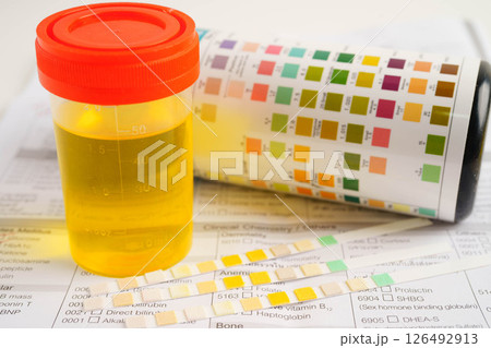 Urinalysis, urine cup for check health examination in laboratory. Urinalysis, urine cup for check health examination in laboratory. 126492913