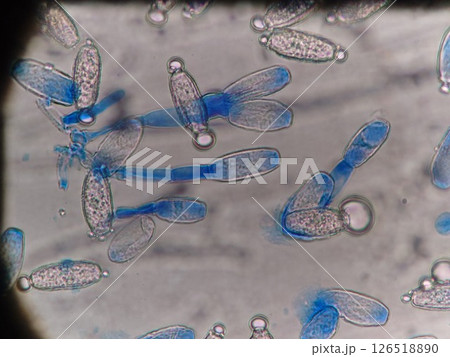 うどん粉病の原因カビの顕微鏡写真 うどん粉病の原因カビの顕微鏡写真 126518890