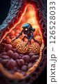 Nanobots Removing Cholesterol in Bloodstream 126528033