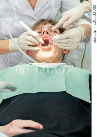 Dental procedure during an examination with a young patient in a modern clinic setting Dental procedure during an examination with a young patient in a modern clinic setting 126532002