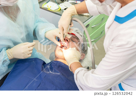 Dental cleaning procedure in a clinic with focus on plaque removal and teeth whiteness 126532042