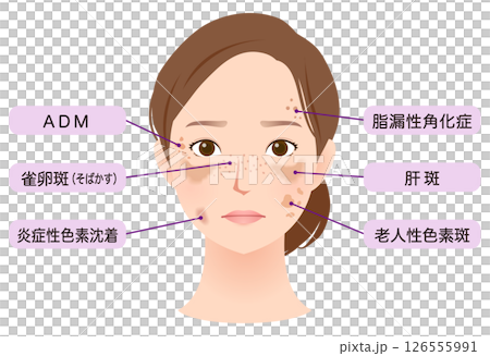 女人臉上有斑點，美麗，名字 126555991