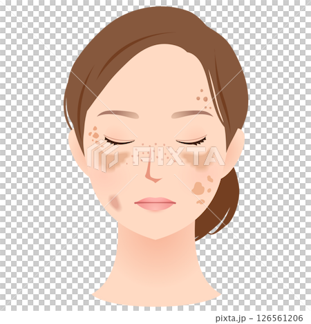 シミができた女性の顔　美容　名称 126561206