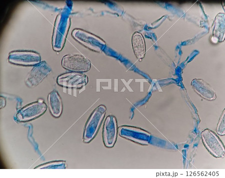 菌糸の先から胞子た作られている様子 菌糸の先から胞子た作られている様子 126562405