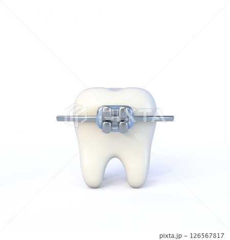 Cute cartoon style tooth with braces 3D 126567817
