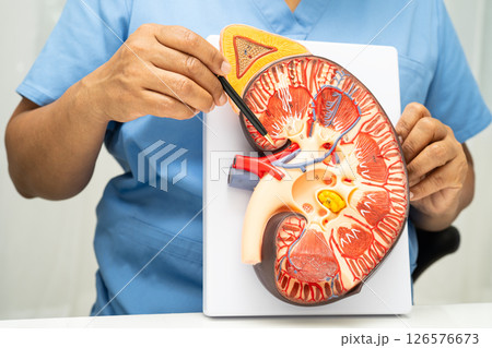 Kidney disease, Chronic kidney disease ckd, Doctor hold human model to treat and study in hospital. 126576673