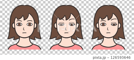 眼瞼下垂の目をした女性の顔と正常な状態 眼瞼下垂の目をした女性の顔と正常な状態 126593646