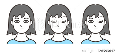 眼瞼下垂の目をした女性の顔と正常な状態 眼瞼下垂の目をした女性の顔と正常な状態 126593647