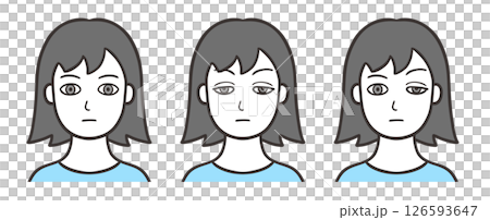 Woman's face with ptosis and normal condition 126593647