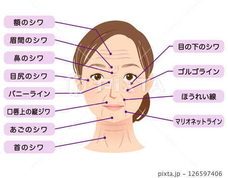 シワの種類　女性の顔　美容 126597406