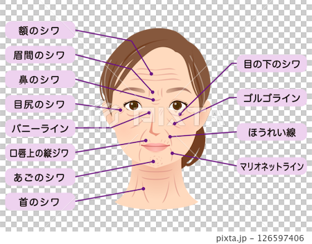 シワの種類　女性の顔　美容 126597406