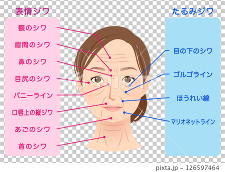皺紋的類型 女性面部 美容 126597464
