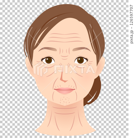 Types of wrinkles Women's face Beauty 126597707