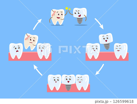 Dental implant procedure . Cartoon character illustration . Isolated on blue background . Vector . 126599618