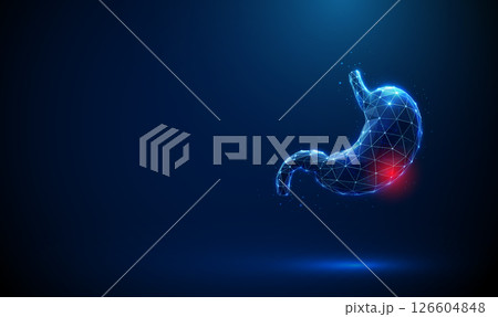Abstract blue human stomach with a red spot indicating focal inflammation. Medical and healthcare concept. Abstract blue human stomach with a red spot indicating focal inflammation. Medical and healthcare concept. 126604848