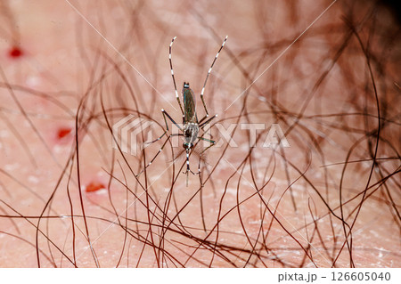 血を吸うヒトスジシマカ 126605040