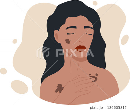 Skin cancer and melanoma awareness month. Woman screening illustration. Person health checkup Skin cancer and melanoma awareness month. Woman screening illustration. Person health checkup 126605815