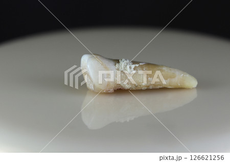 A sick, damaged human tooth. 126621256