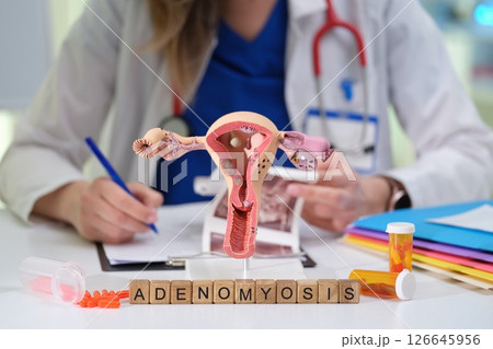 Adenomyosis A visual guide for health professionals to improve their understanding 126645956