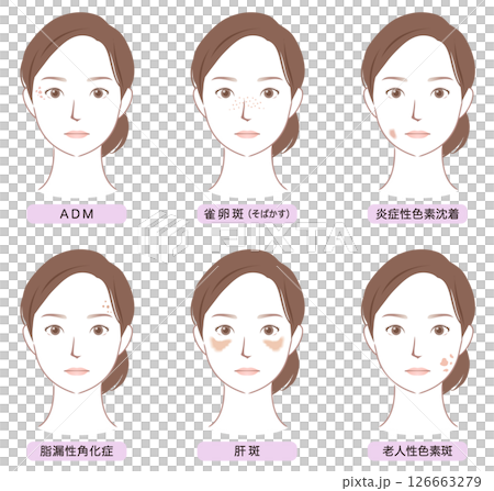 臉部斑點的類型 美容女性 126663279