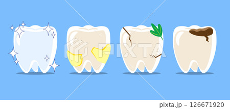 Healthy teeth, dental plaque, cracked tooth with food stuck, dental caries or tooth decayed . Set of flat design cartoon illustration . Isolated on Blue background . Vector . 126671920