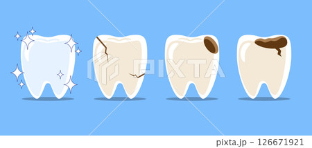 Healthy teeth, Cracked tooth, dental caries or tooth decayed . Set of flat design cartoon illustration . Isolated on Blue background . Vector . Healthy teeth, Cracked tooth, dental caries or tooth decayed . Set of flat design cartoon illustration . Isolated on Blue background . Vector . 126671921