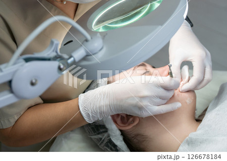 Dermatologist Magnifying Lamp Skin Examination: Clinic Facial Treatment Procedure 126678184