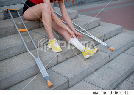 Girl with leg injury sits on the stairs with crutches. 126681419