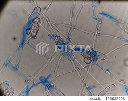 菌糸から生えるカビの胞子 126682908