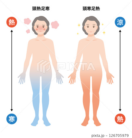 頭寒足熱 126705979