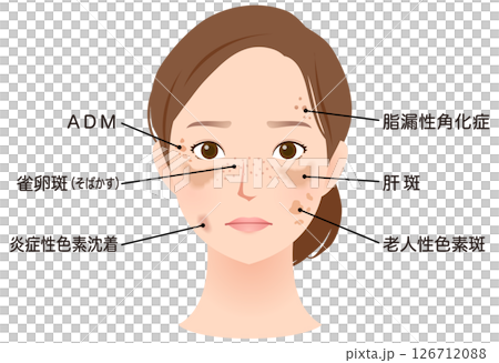 女人臉上有斑點，美麗，名字 126712088