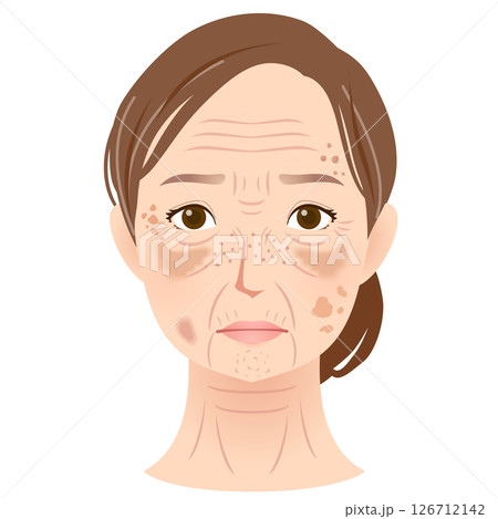 シミができた女性の顔　美容　シニア女性 126712142