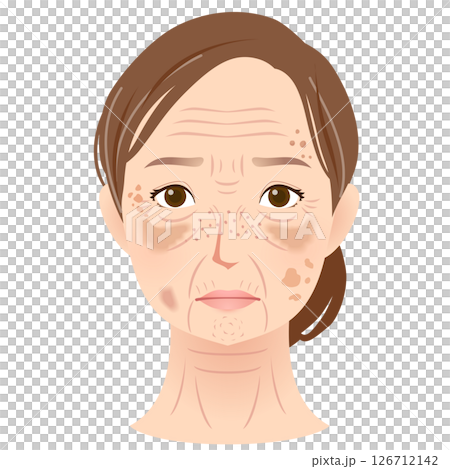 Woman's face with spots, beauty, senior woman 126712142