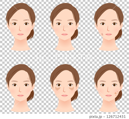 臉部斑點的類型 美容女性 126712431