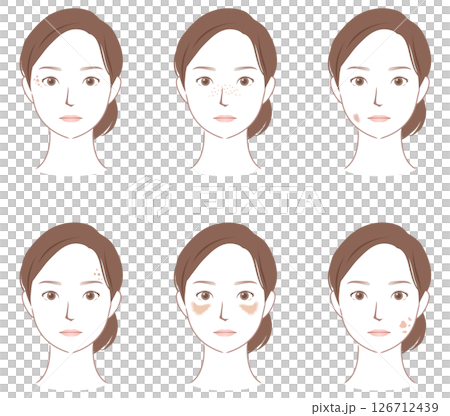臉部斑點的類型 美容女性 126712439