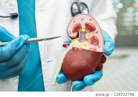 Kidney disease, Chronic kidney disease ckd, Doctor hold human model to treat and study in hospital. Kidney disease, Chronic kidney disease ckd, Doctor hold human model to treat and study in hospital. 126722786
