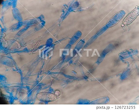 上え上えと伸びるカビの胞子 126723255