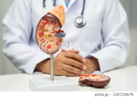 Chronic kidney disease, doctor with model for treatment urinary system, urology, Estimated glomerular filtration rate eGFR. 126728676