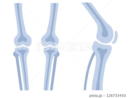 Human knees bones and joints, examination and diagnosis. Healthcare and rheumatism analysis, physical care in hospital or clinics. Vector illustration. 126733450