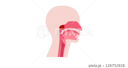 Enlarged adenoids poster 126752838