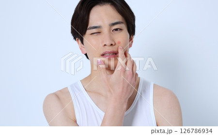 ニキビや腫れ物に悩む男性イメージ ニキビや腫れ物に悩む男性イメージ 126786934