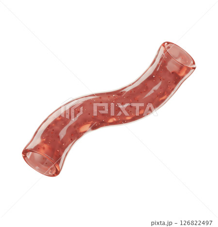 Curved Human Vessel with Red Fluid for Medical Concepts Curved Human Vessel with Red Fluid for Medical Concepts 126822497