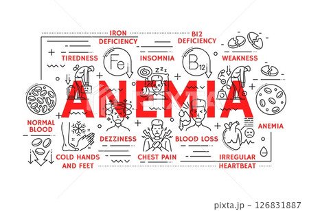 Anemia symptoms, hematology icons, anaemia disease treatment and iron deficiency medical test. Vector line red blood cells, laboratory research, anemia and hemophilia treatment icons Anemia symptoms, hematology icons, anaemia disease treatment and iron deficiency medical test. Vector line red blood cells, laboratory research, anemia and hemophilia treatment icons 126831887