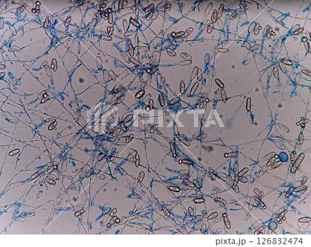染色して青くなったうどん粉病の菌糸 126832474
