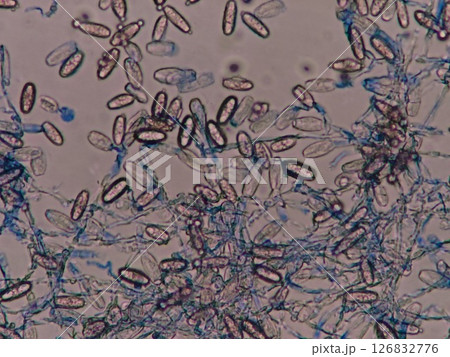 胞子で広がるうどん粉病 126832776