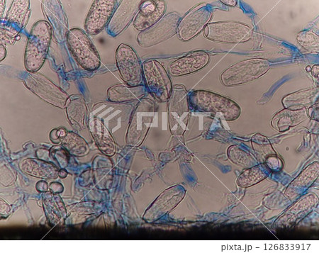 植物の葉にくっつくカビの菌足と胞子 植物の葉にくっつくカビの菌足と胞子 126833917