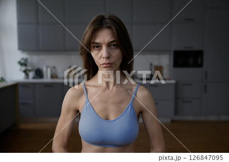 Portrait of anorexic woman with exhausted face and downcast look Portrait of anorexic woman with exhausted face and downcast look 126847095