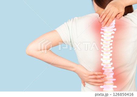 Woman suffering from back pain with anatomy of spine and xray for diagnosis over blue background. Common causes include injuries like inflammation of muscle ache or spinal stenosis. 126850416