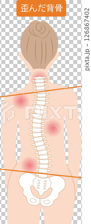 脊椎扭曲的女人 126867402